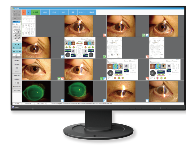 EZCap Eye 画面イメージ